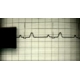 Ekg Cihazı Kalemi