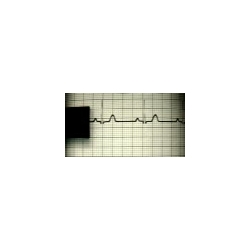 Ekg Cihazı Kalemi
